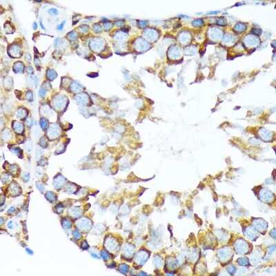 Immunohistochemistry-Paraffin: STI1 Antibody (4S8L6) [NBP3-15246]
