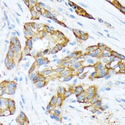 Immunohistochemistry-Paraffin: STI1 Antibody (4S8L6) [NBP3-15246]