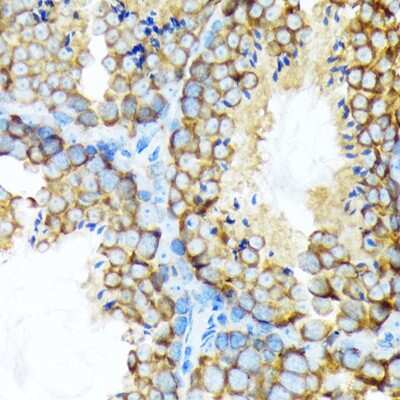 Immunohistochemistry-Paraffin: STI1 Antibody (4S8L6) [NBP3-15246]