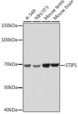 Western Blot: STI1 Antibody (4S8L6) [NBP3-15246]