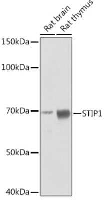 Western Blot: STI1 Antibody (4S8L6) [NBP3-15246]