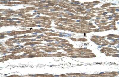 Immunohistochemistry-Paraffin: STI1 Antibody [NBP1-57837]