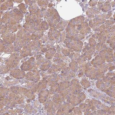 Immunohistochemistry-Paraffin: STI1 Antibody [NBP2-32621]