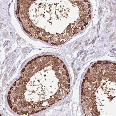 Immunohistochemistry-Paraffin: STI1 Antibody [NBP2-32621]