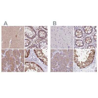 Immunohistochemistry-Paraffin: STI1 Antibody [NBP2-32621]