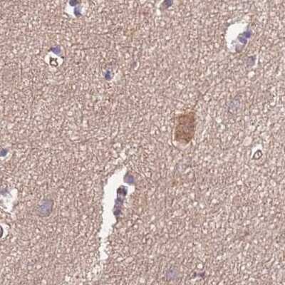 Immunohistochemistry-Paraffin: STI1 Antibody [NBP2-32621]