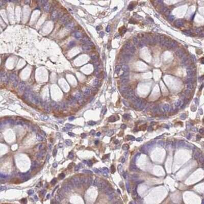 Immunohistochemistry-Paraffin: STI1 Antibody [NBP2-32621]