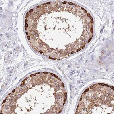 Immunohistochemistry-Paraffin: STI1 Antibody [NBP2-33411]