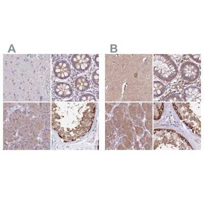 Immunohistochemistry-Paraffin: STI1 Antibody [NBP2-33411]