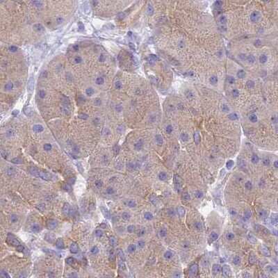 Immunohistochemistry-Paraffin: STI1 Antibody [NBP2-33411]