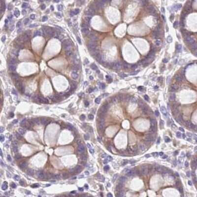 Immunohistochemistry-Paraffin: STI1 Antibody [NBP2-33411]
