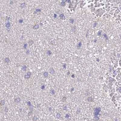 Immunohistochemistry-Paraffin: STI1 Antibody [NBP2-33411]
