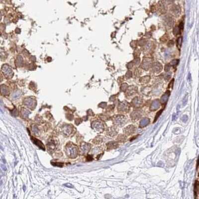 Immunohistochemistry-Paraffin: STI1 Antibody [NBP2-33411]