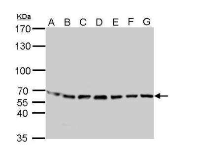 Western Blot: STI1 Antibody [NBP1-32145]