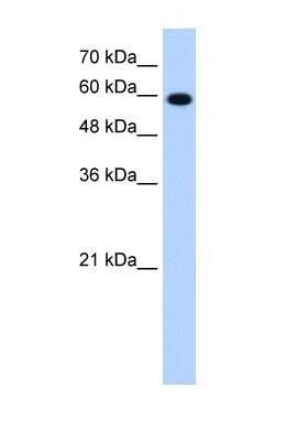 Western Blot: STI1 Antibody [NBP1-57837]