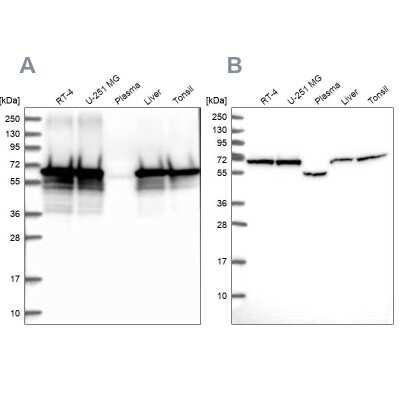 Western Blot: STI1 Antibody [NBP2-32621]