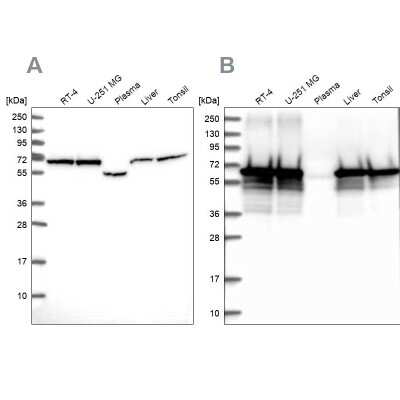 Western Blot: STI1 Antibody [NBP2-33411]