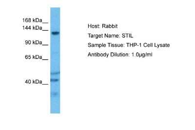 Western Blot: STIL Antibody [NBP2-83601]