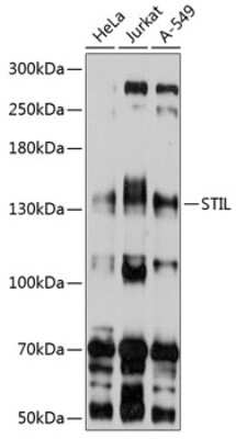 Western Blot: STIL AntibodyBSA Free [NBP2-93458]