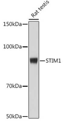 Western Blot: STIM1 Antibody (1Z7E3) [NBP3-16878]