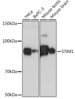 Western Blot: STIM1 Antibody (1Z7E3) [NBP3-16878]