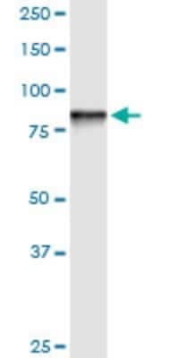 Western Blot: STIM1 Antibody (5A2) [H00006786-M01]