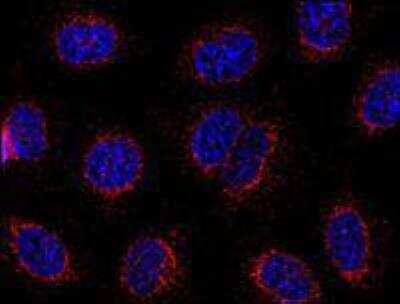 Immunocytochemistry/ Immunofluorescence: STIM1 Antibody (CDN3H4) - BSA Free [NB110-55300]
