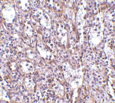 Immunohistochemistry-Paraffin: STIM1 Antibody - BSA Free [NBP1-76789]