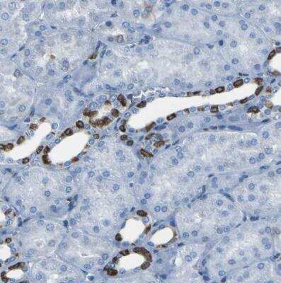 Immunohistochemistry-Paraffin: STIM1 Antibody [NBP1-84322]