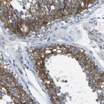 Immunohistochemistry-Paraffin: STIM1 Antibody [NBP1-84322]