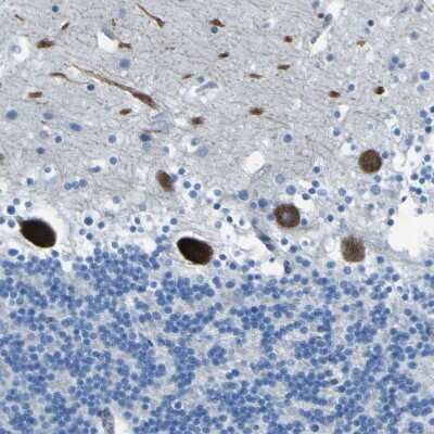 Immunohistochemistry-Paraffin: STIM1 Antibody [NBP1-84322]