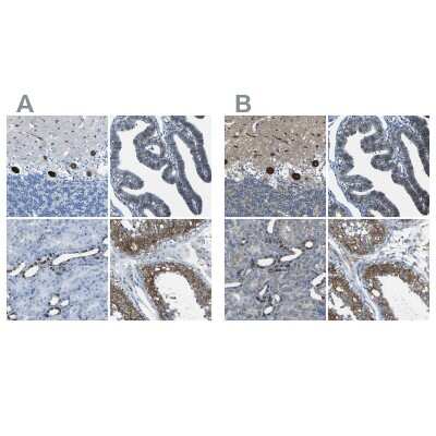 Immunohistochemistry-Paraffin: STIM1 Antibody [NBP1-84322]