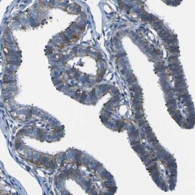Immunohistochemistry-Paraffin: STIM1 Antibody [NBP1-84322]