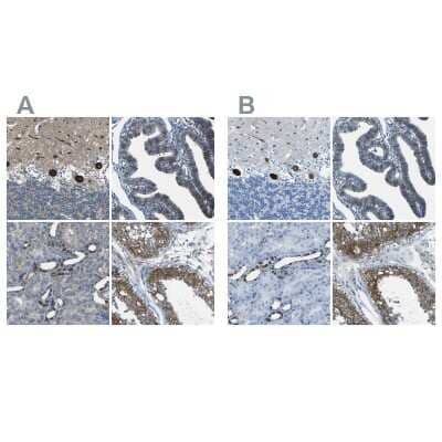 Immunohistochemistry-Paraffin: STIM1 Antibody [NBP1-84323]