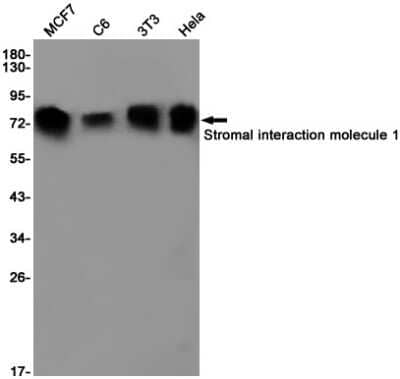 Western Blot: STIM1 Antibody (S07-9F9) [NBP3-14979]