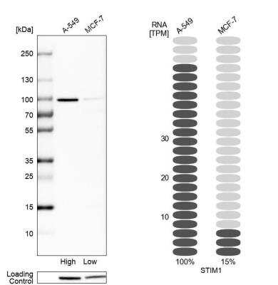 Western Blot: STIM1 Antibody [NBP1-84322]