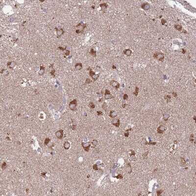 Immunohistochemistry: STIM2 Antibody [NBP2-37882]