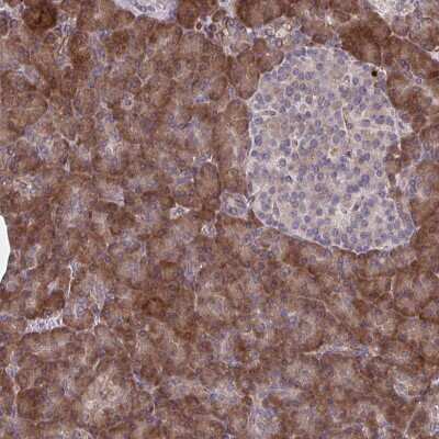 Immunohistochemistry: STIM2 Antibody [NBP2-37964]