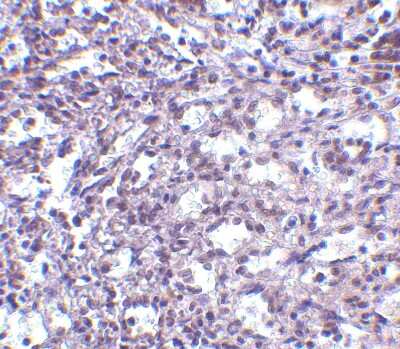 Immunohistochemistry-Paraffin: STIM2 Antibody - BSA Free [NBP1-76790]