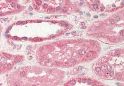 Immunohistochemistry-Paraffin: STIM2 Antibody [NBP2-44170]