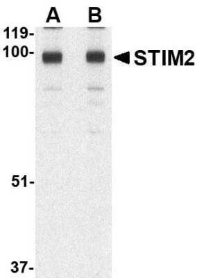 Western Blot: STIM2 AntibodyBSA Free [NBP1-76790]