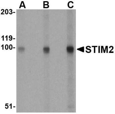 Western Blot: STIM2 AntibodyBSA Free [NBP1-76791]