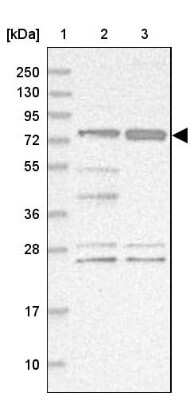 Western Blot: STIM2 Antibody [NBP2-37882]