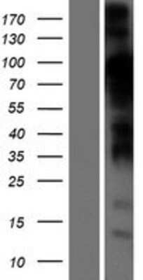 Western Blot: STIM2 Overexpression Lysate [NBP2-04381]