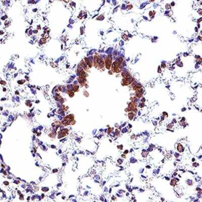 Immunohistochemistry: STING/TMEM173 Antibody (2922D) - Azide and BSA Free [NBP3-18817]