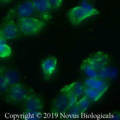 Immunocytochemistry/ Immunofluorescence: STING/TMEM173 Antibody - BSA Free [NBP2-24683]