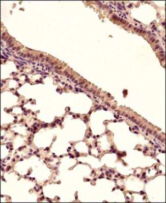 Immunohistochemistry-Paraffin: STING/TMEM173 Antibody - BSA Free [NBP2-24683]