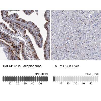 Immunohistochemistry-Paraffin: STING/TMEM173 Antibody [NBP2-38389]