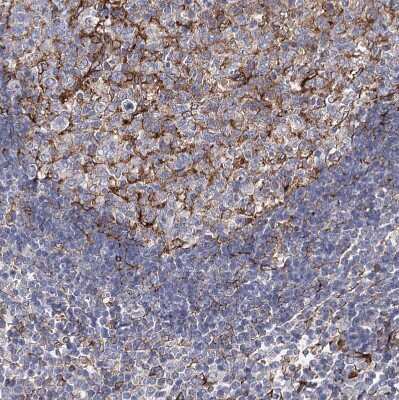 Immunohistochemistry-Paraffin: STING/TMEM173 Antibody [NBP2-48684]