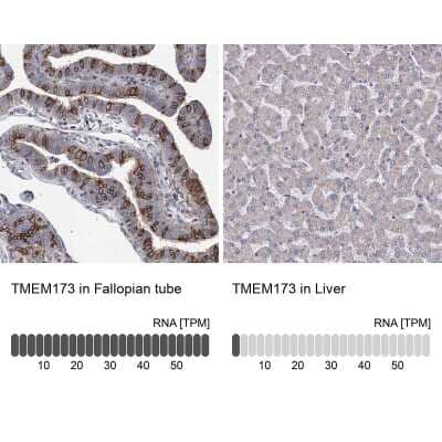 Immunohistochemistry-Paraffin: STING/TMEM173 Antibody [NBP2-48684]